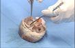 CHU : Nouvelles salles de plastination
